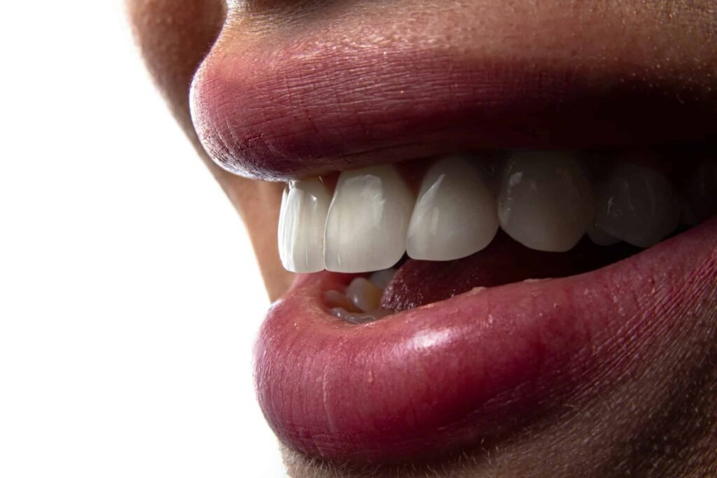 straight teeth