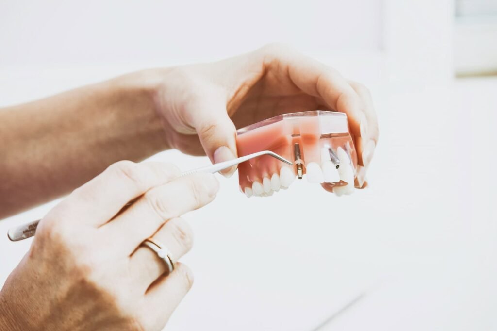 dental implants model