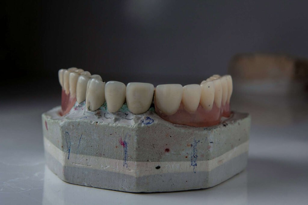 Dentures