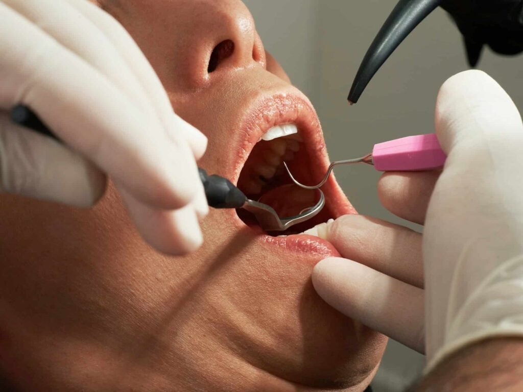 Root Canal Appointment