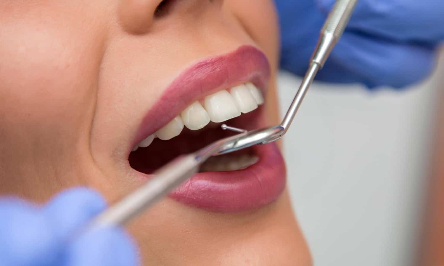 dental emergencies