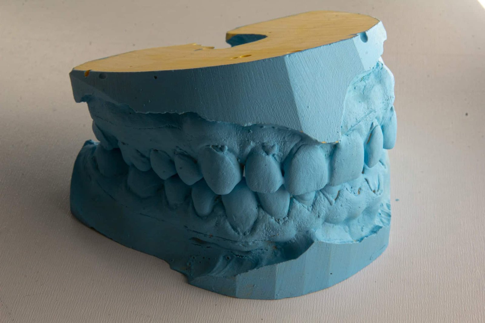 invisalign